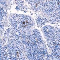 鼠抗人CD61单克隆抗体  TDCCM-0680