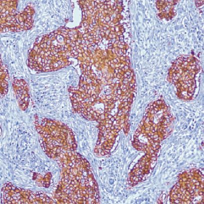 鼠抗人C-erbB-2癌基因蛋白单克隆抗体  TDCCM-0844