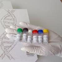 兔抗人B细胞CLL/淋巴瘤7B多克隆抗体