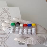 兔抗人极光激酶A多克隆抗体