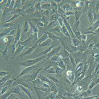 HBVSMC-T【HBVSMC】永生化人脑血管平滑肌细胞