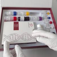 人粒细胞趋化蛋白-2(GCP-2/CXCL6)ELISA试剂盒价格