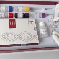 人淋巴细胞功能相关抗原1(LFA-1/CD11a+CD18)ELISA试剂盒说明