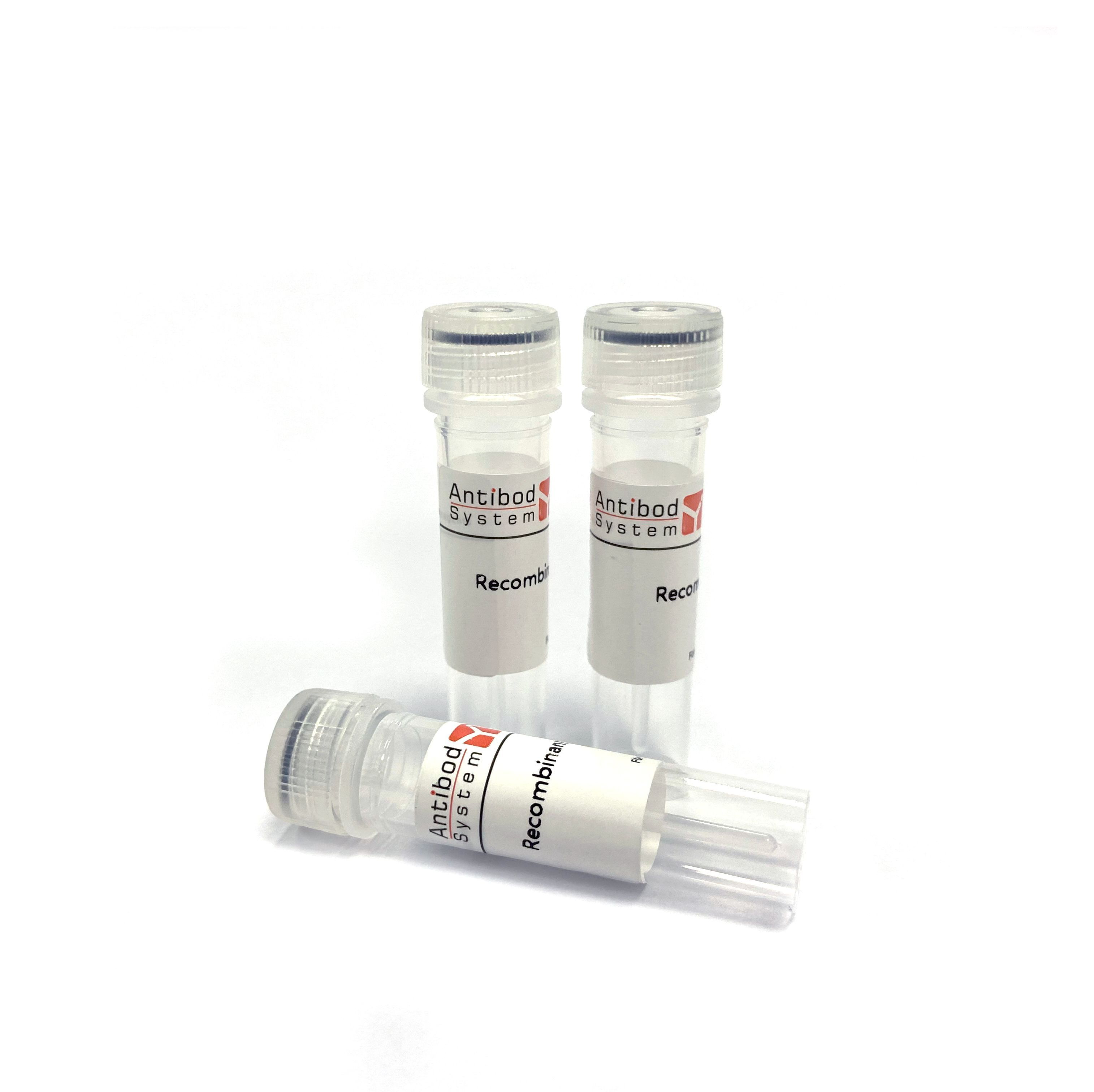 Recombinant HPV16 E6/Protein E6 Protein, N-His（重组蛋白） | HPV16 E6/Protein E6蛋白 | HPV16 E6/Protein E6 Protein