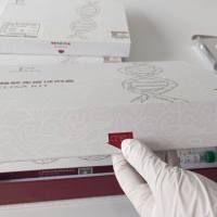 人白介素2受体(IL-2R)ELISA试剂盒