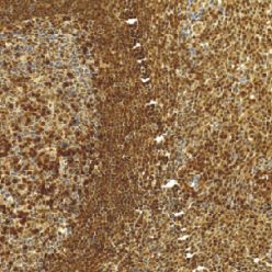 鼠抗人p27单克隆抗体 TDCPM-0120