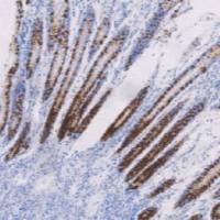 鼠抗人粘液素糖蛋白2单克隆抗体 TDCMM-0261