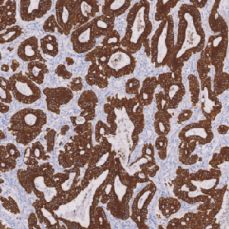 鼠抗人细胞角蛋白18单克隆抗体  TDCCM-1090