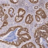 鼠抗人错配修复蛋白1单克隆抗体 TDCMM-0182