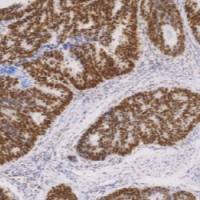 鼠抗人错配修复蛋白6单克隆抗体 TDCMM-0202