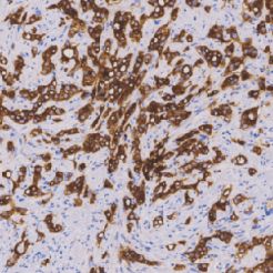 兔抗人前列腺特异性抗原单克隆抗体  TDCPR-0411