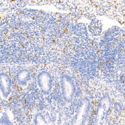 鼠抗人CD163单克隆抗体  TDCCM-0801