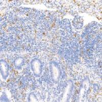 鼠抗人CD163单克隆抗体 TDCCM-0801