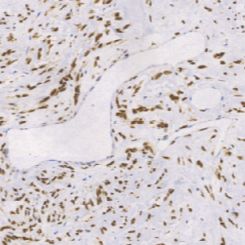 兔抗人STAT6单克隆抗体  TDCSR-0281