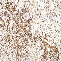 兔抗人CDK4单克隆抗体  TDCCR-0816
