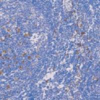 鼠抗人CD163单克隆抗体  TDCCM-0802