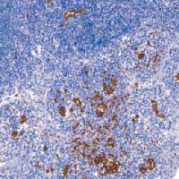 鼠抗人CD235a单克隆抗体   TDCCM-0810