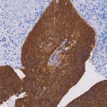 兔抗人细胞角蛋白4单克隆抗体  TDCCR-1260