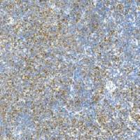 鼠抗人神经(管)嵴转录因子11单克隆抗体 TDCSM-0190