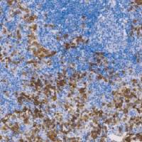 鼠抗人PNL2单克隆抗体 TDCPM-0340