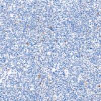 鼠抗人肌细胞生成素单克隆抗体  TDCMM-0340