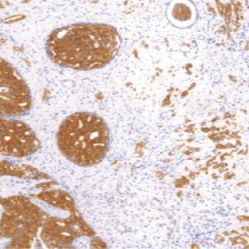 鼠抗人细胞角蛋白（低分子量）单克隆抗体  TDCCM-0920
