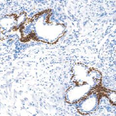 鼠抗人p63蛋白单克隆抗体  TDCPM-0160
