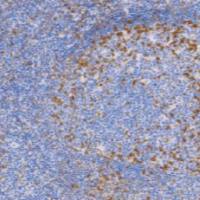 鼠抗人PD1单克隆抗体 TDCPM-0270