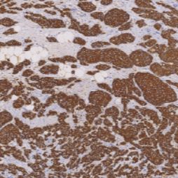 鼠抗人粘液素糖蛋白1单克隆抗体 TDCMM-0250