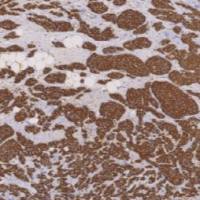 鼠抗人粘液素糖蛋白1单克隆抗体 TDCMM-0250