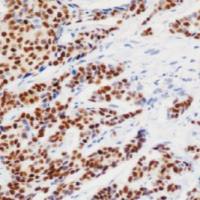 鼠抗人孕激素受体单克隆抗体 TDCPM-0365