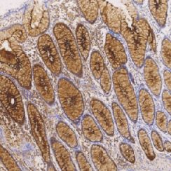 鼠抗人癌胚抗原单克隆抗体  TDCCM-0832
