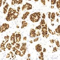 鼠抗人Pax-8单克隆抗体 TDCPM-0252