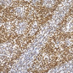 鼠抗人TLE1单克隆抗体 TDCTM-0170