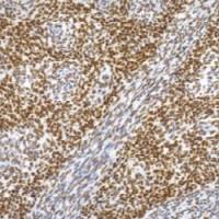 鼠抗人TLE1单克隆抗体   TDCTM-0170