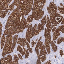 鼠抗人细胞角蛋白（低分子量）单克隆抗体  TDCCM-0930