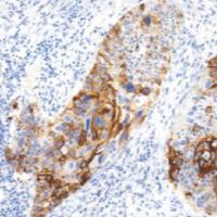 鼠抗人TAG-72单克隆抗体 TDCTM-0110