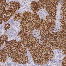 鼠抗人p53蛋白单克隆抗体  TDCPM-0140
