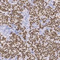 鼠抗人SALL4单克隆抗体  TDCSM-0130