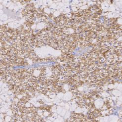 鼠抗人甲状旁腺激素单克隆抗体  TDCPM-0190