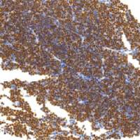 鼠抗人末端脱氧核糖核苷酸转移酶单克隆抗体 TDCTM-0132