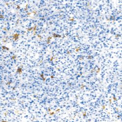 兔抗人催乳素单克隆抗体 TDCPR-0371