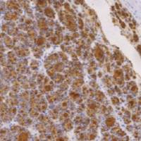 鼠抗人甲状腺球蛋白单克隆抗体  TDCTM-0152