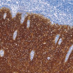 兔抗人细胞角蛋白10单克隆抗体  TDCCR-1020