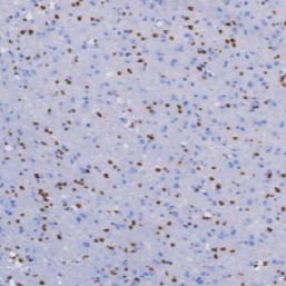 兔抗人少突胶质细胞转录因子2单克隆抗体  TDCOR-0031