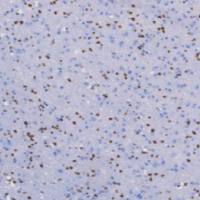 兔抗人少突胶质细胞转录因子2单克隆抗体 TDCOR-0031