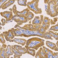 兔抗人c-Met 单克隆抗体 TDCCR-0250