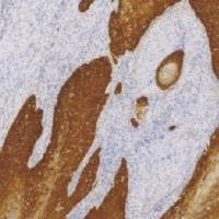 兔抗人细胞角蛋白 5 & 14 单克隆抗体  TDCCR-1160