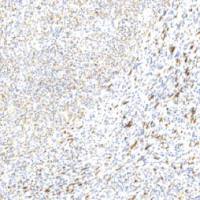 兔抗人肌调节蛋白单克隆抗体 TDCMR-0331