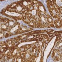 鼠抗人P16单克隆抗体 TDCPM-0103